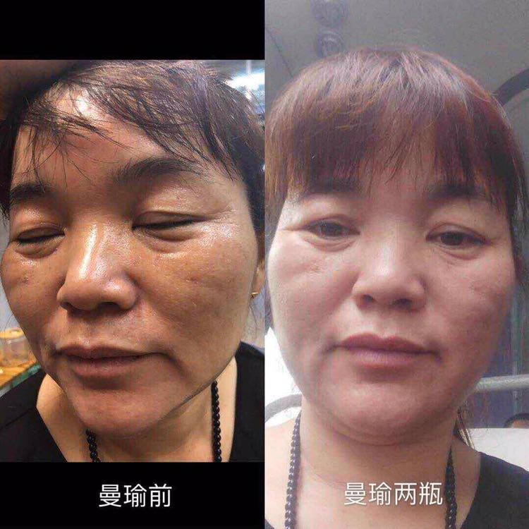 曼瑜天雅 排毒抗衰老 从此告别粗糙无光泽