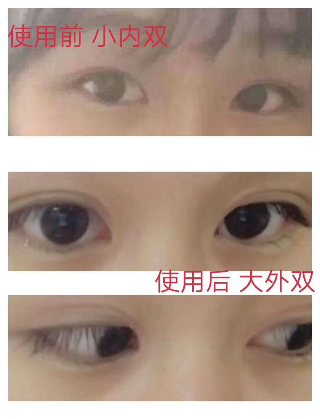 扩眼精油，不用动手术就可以变成双眼皮