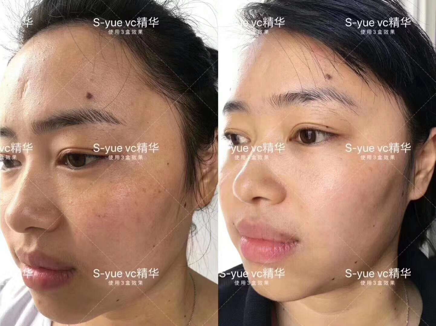 奢悦vc精华，净透vc精华，大大效果提亮肤色