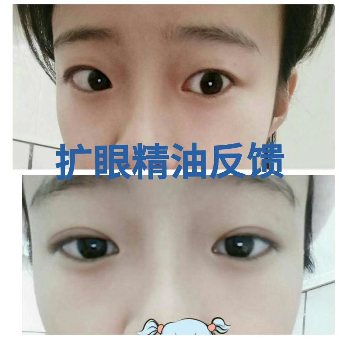 双眼皮精华   扩眼精油