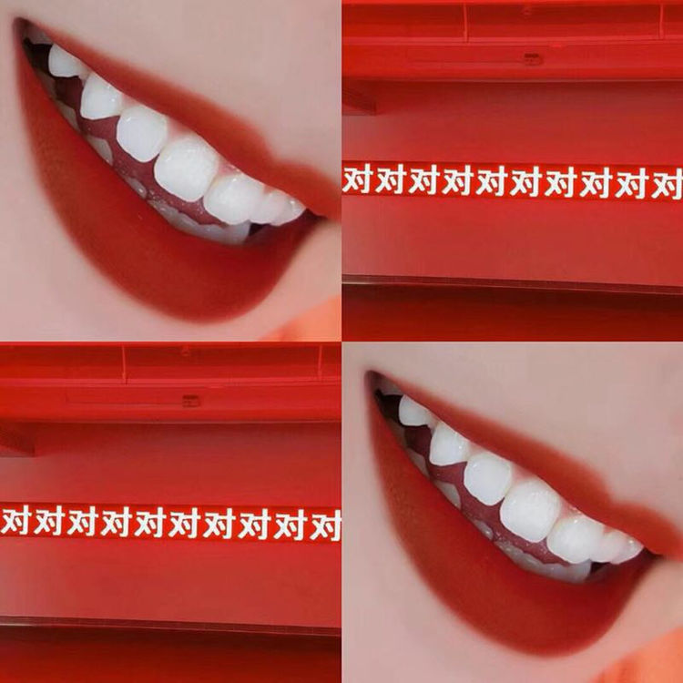 唯爱冷光美牙仪