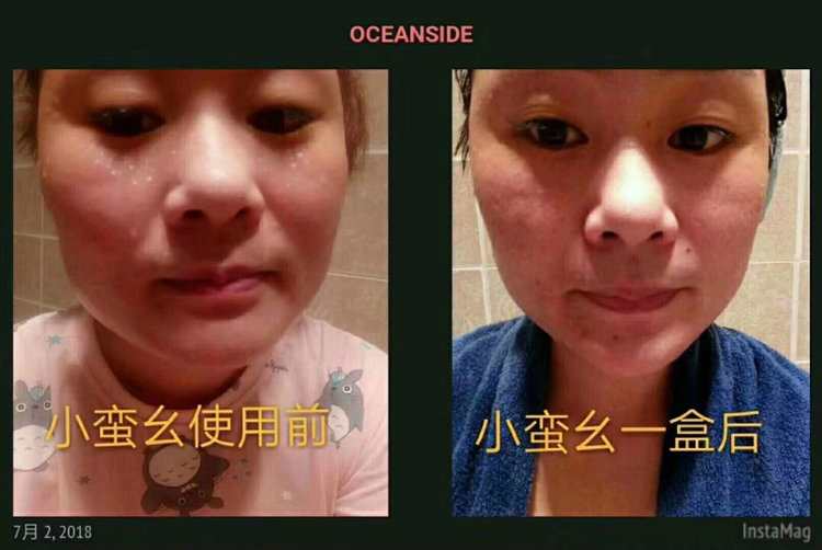 小蛮幺懒人抹抹瘦，不节食不运动不反弹，全身可用，抹哪瘦哪！