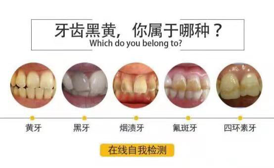 碧缇福美牙仪 美白牙齿找我