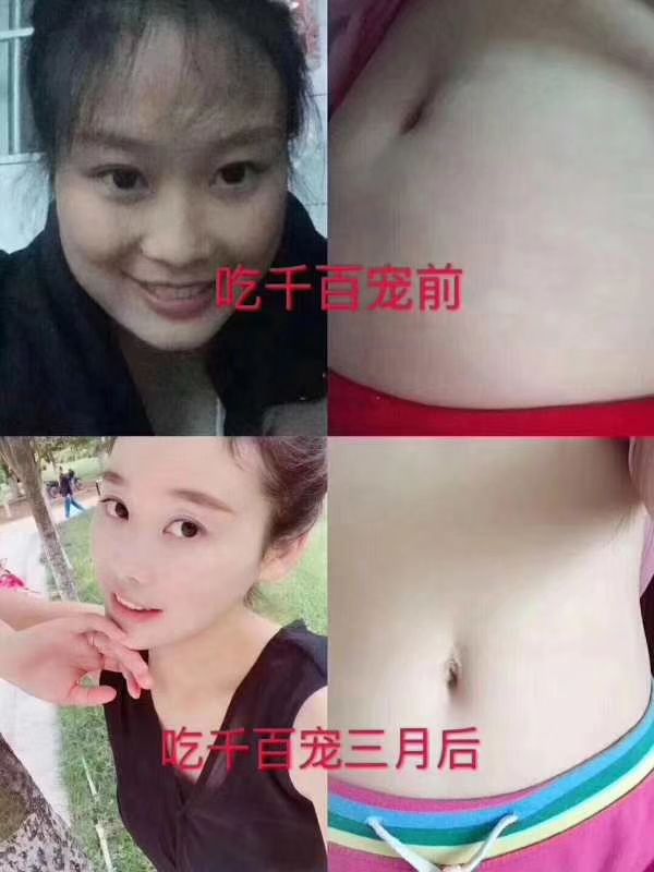 仟佰宠瘦身产品 不需节食 不需运动 健康瘦身