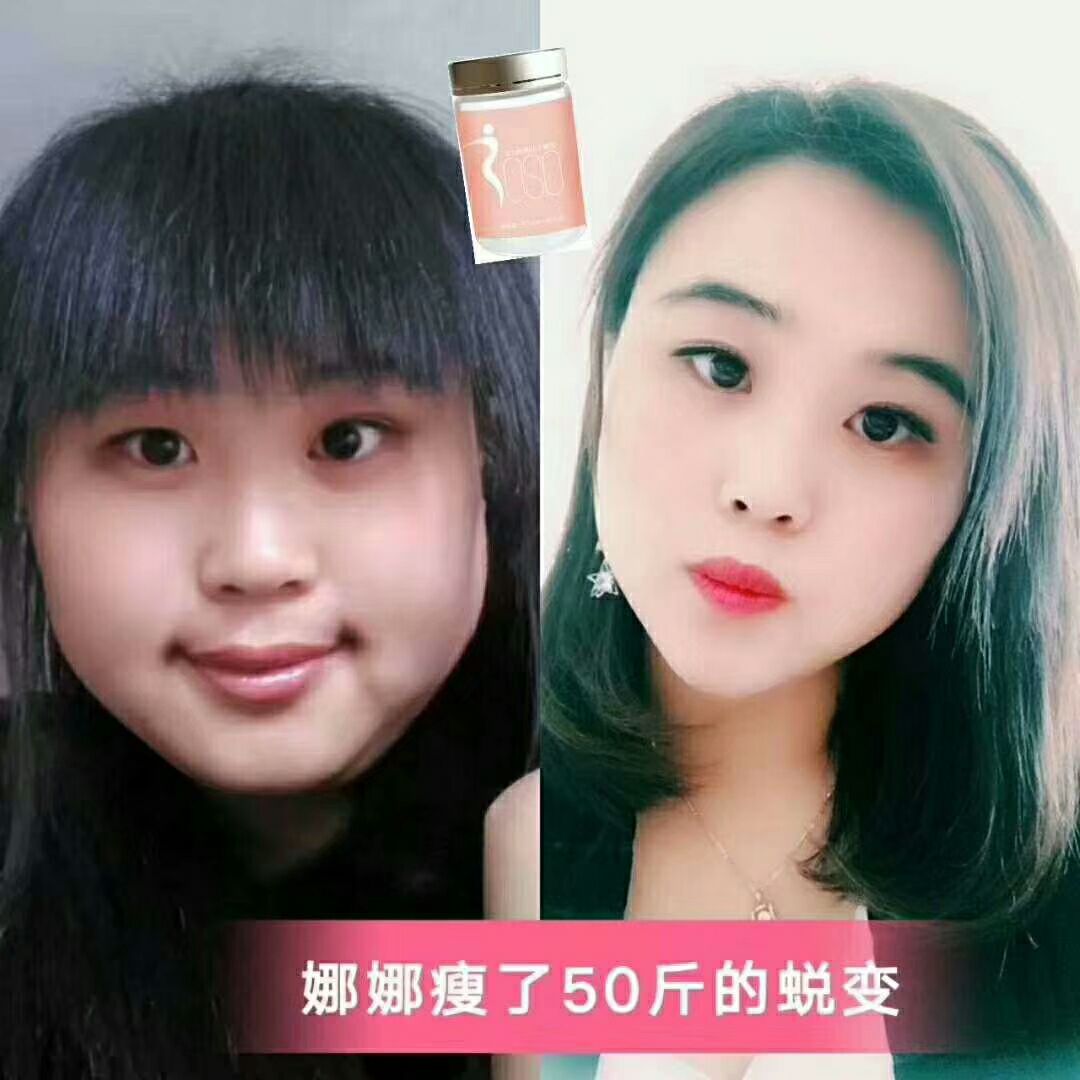 soso食品糖果 减肥瘦身主攻各种顽固体质！包瘦10～30斤