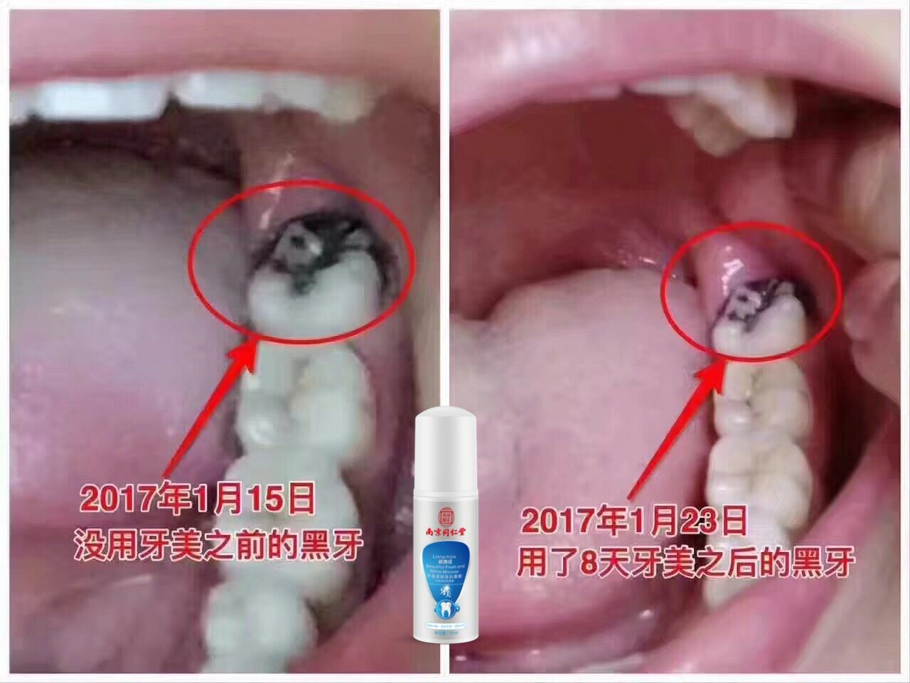南京同仁堂洁白慕斯牙美 代替牙膏漱口水