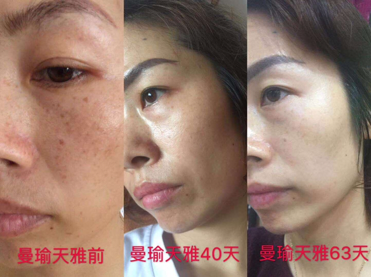 曼瑜天雅 排毒抗衰老 从此告别粗糙无光泽