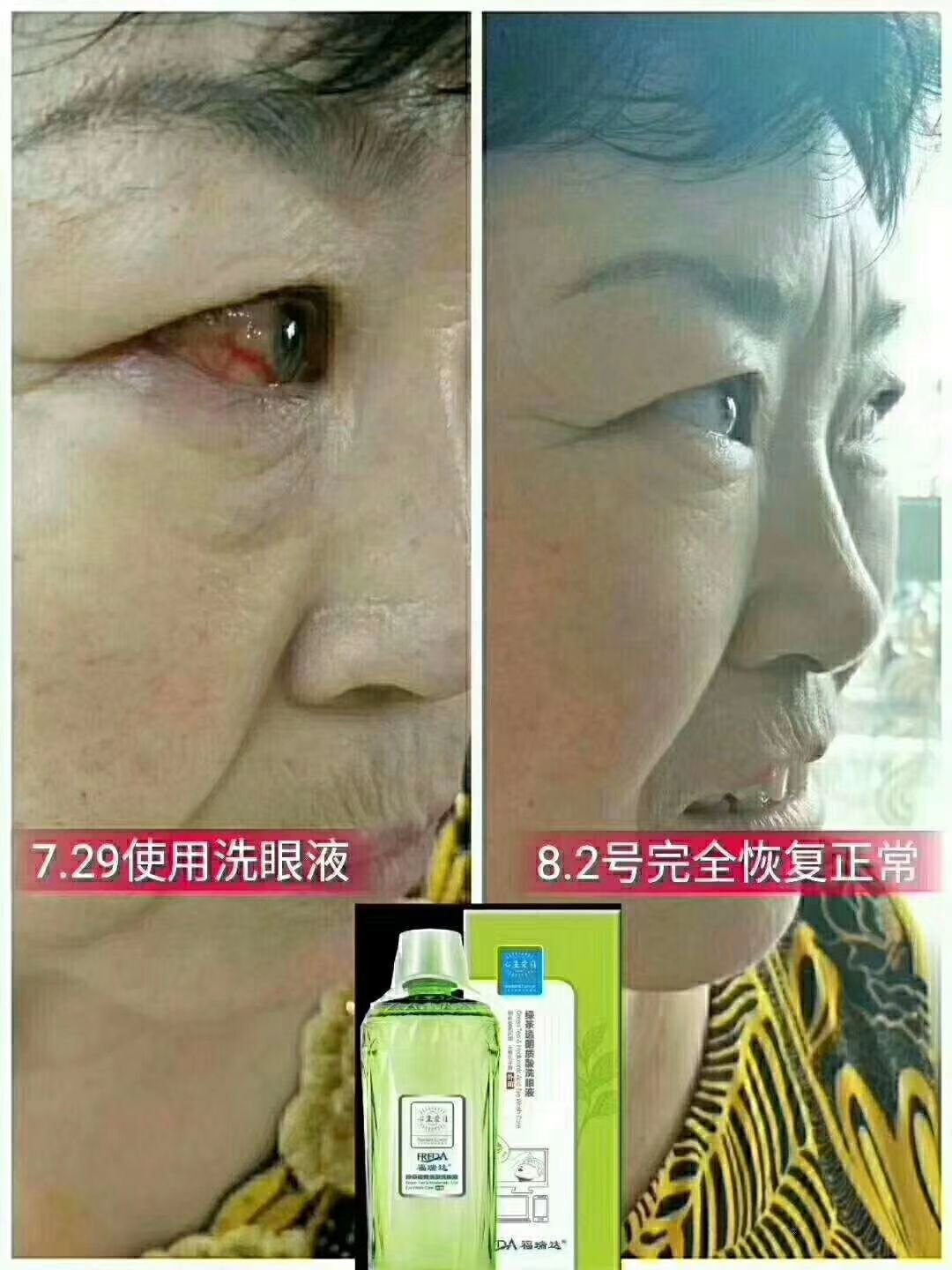 国企微商，福瑞达心生爱目洗眼液