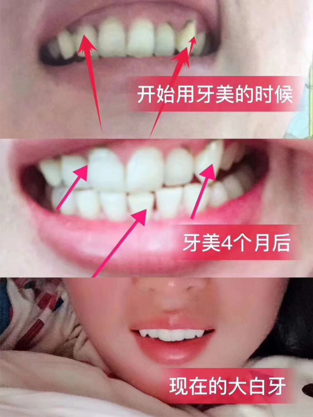 南京同仁堂洁白慕斯牙美 代替牙膏漱口水