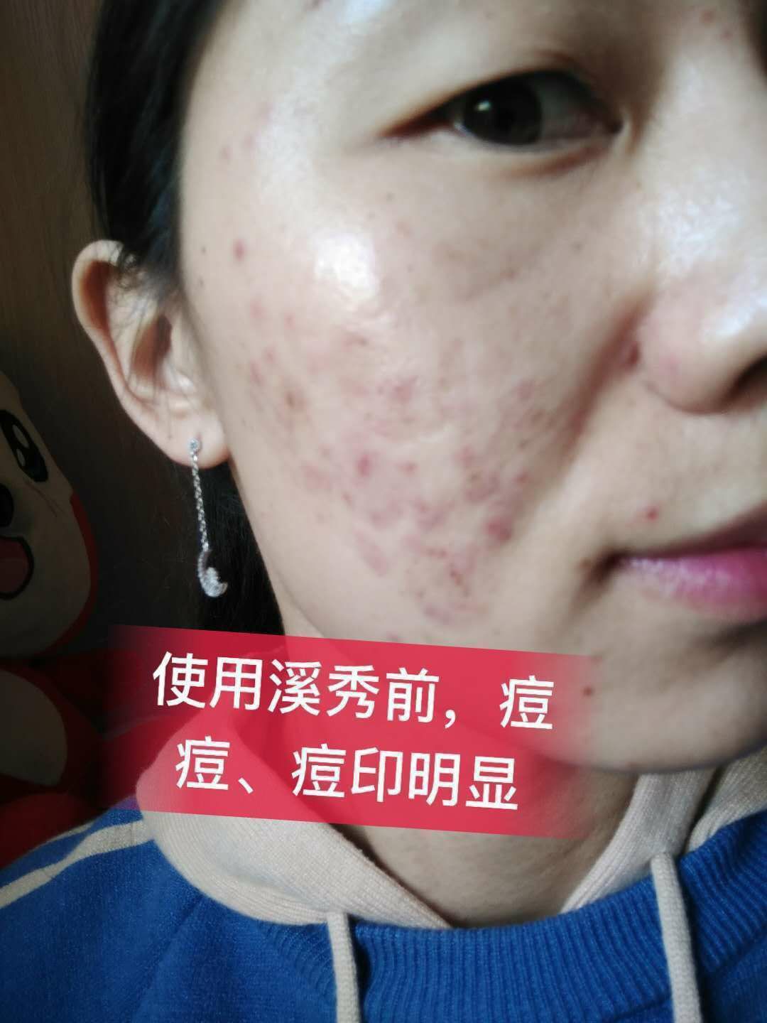 溪秀面膜 小绿盒 明星代言品牌