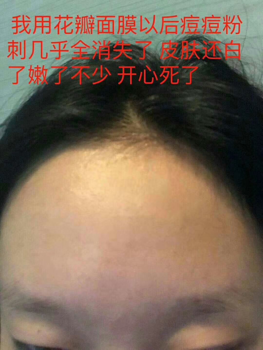 冰亦花瓣冰膜 。美白补水祛痘淡斑，促进皮肤的新陈代谢  …