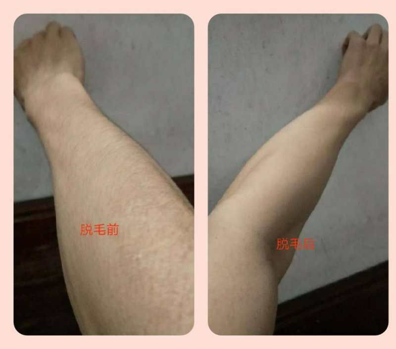 慕斯脱毛喷雾 安全 温和 能滋润肌肤