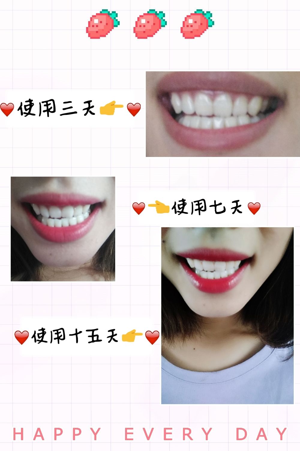 碧缇福美牙神器