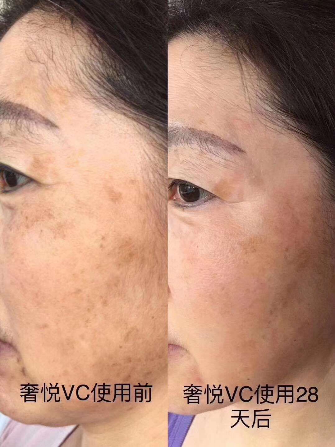 奢悦vc精华，净透vc精华，大大效果提亮肤色