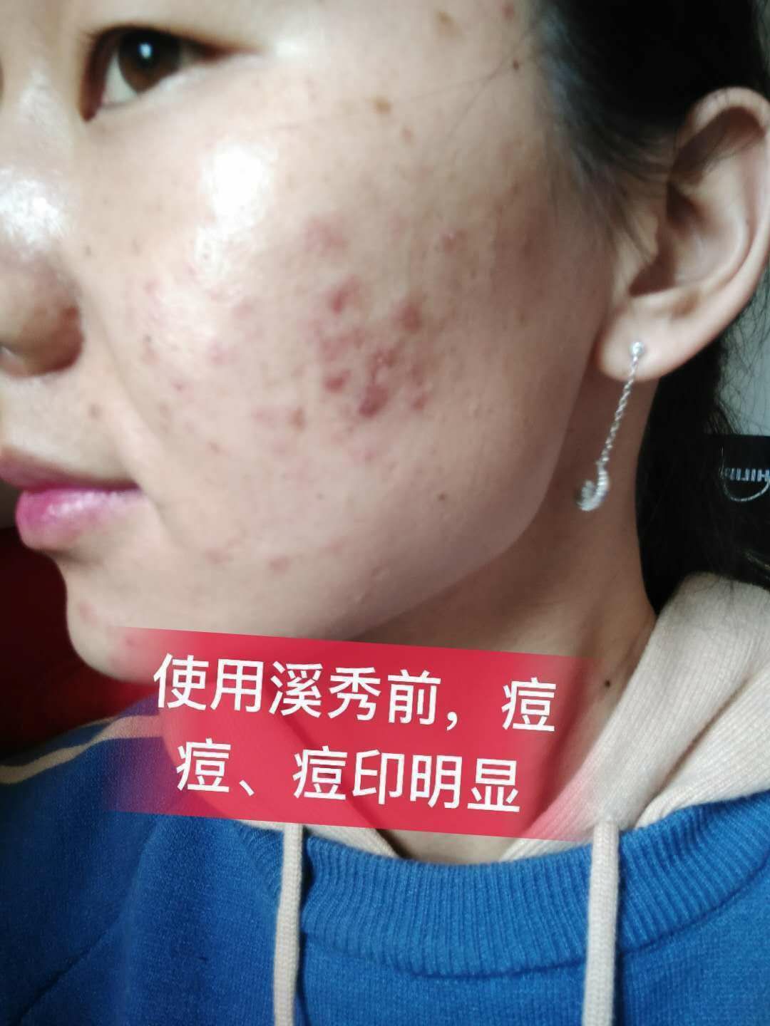 溪秀面膜 小绿盒 明星代言品牌
