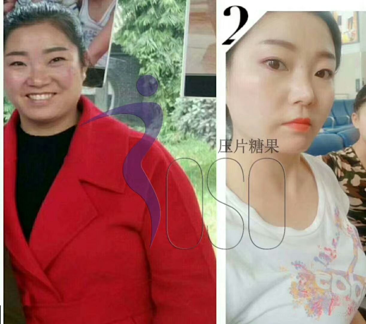 soso食品糖果 减肥瘦身主攻各种顽固体质！包瘦10～30斤
