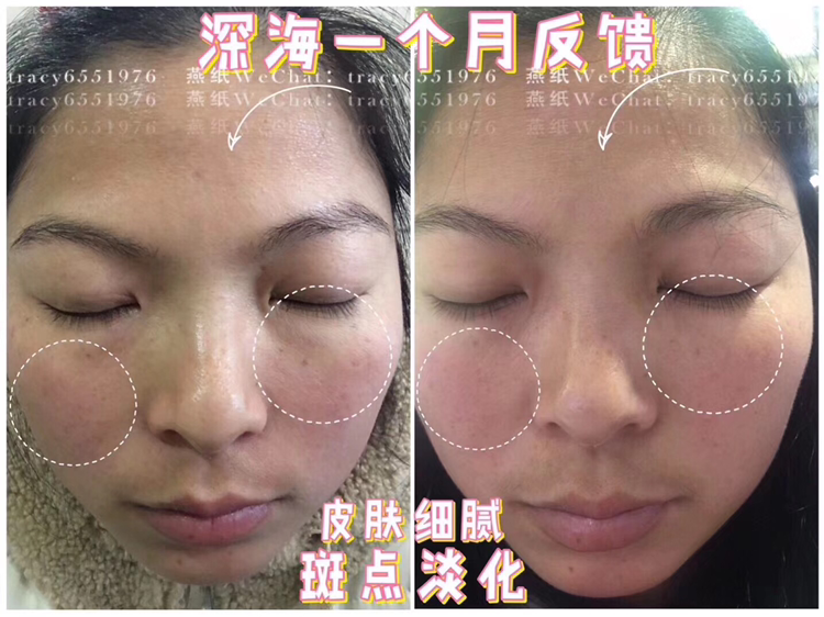 日弥胶原蛋白变美、变瘦