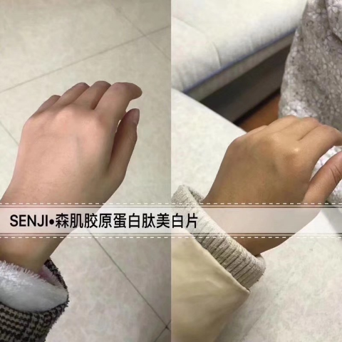 森肌胶原蛋白美白片正品 效果100%