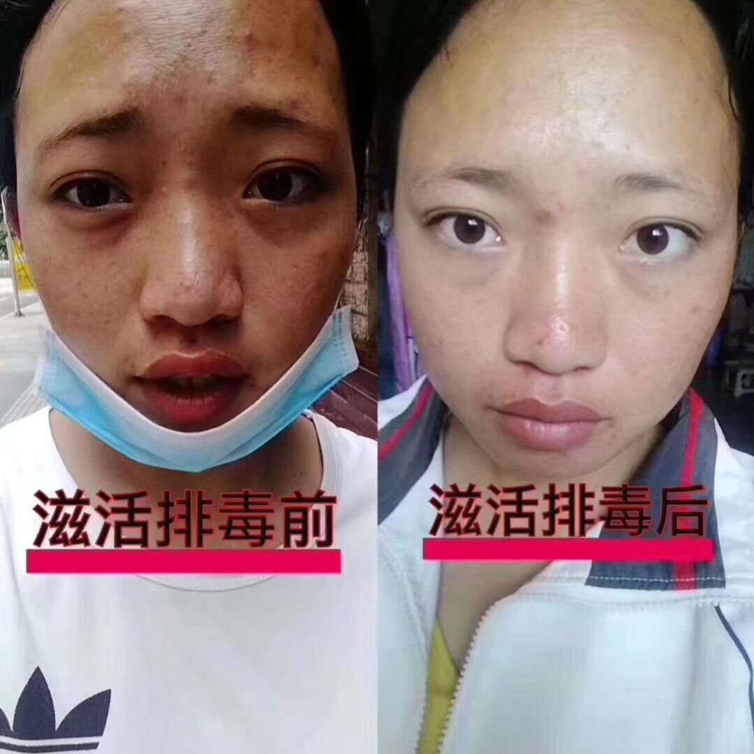滋活焕颜排毒素 全面滋养调理皮肤的美肤产品