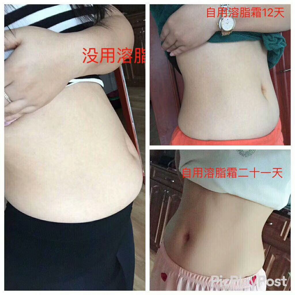 蜜拉贝儿微塑溶脂霜 让你改变不一样的自己！