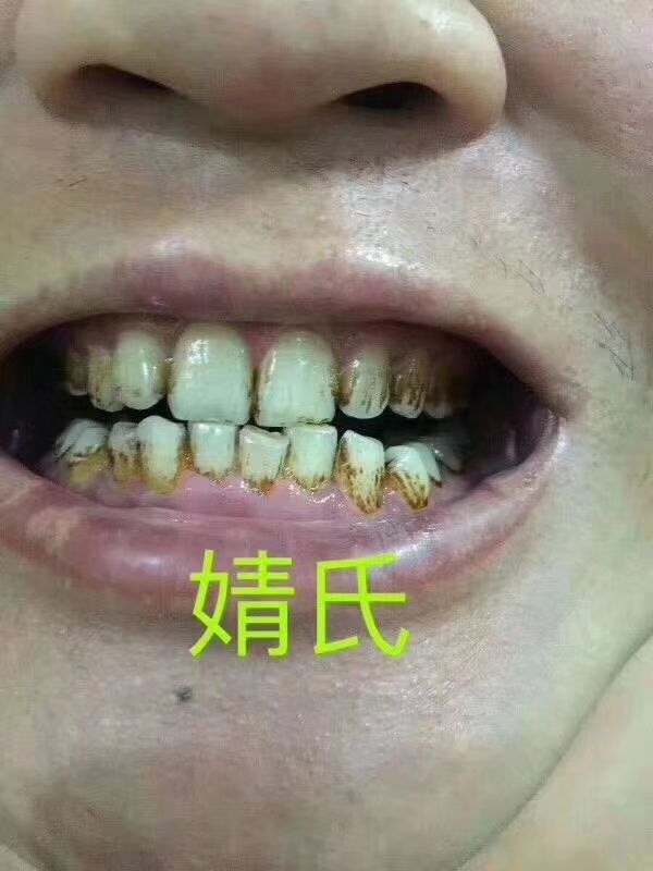 婧氏草本牙膏