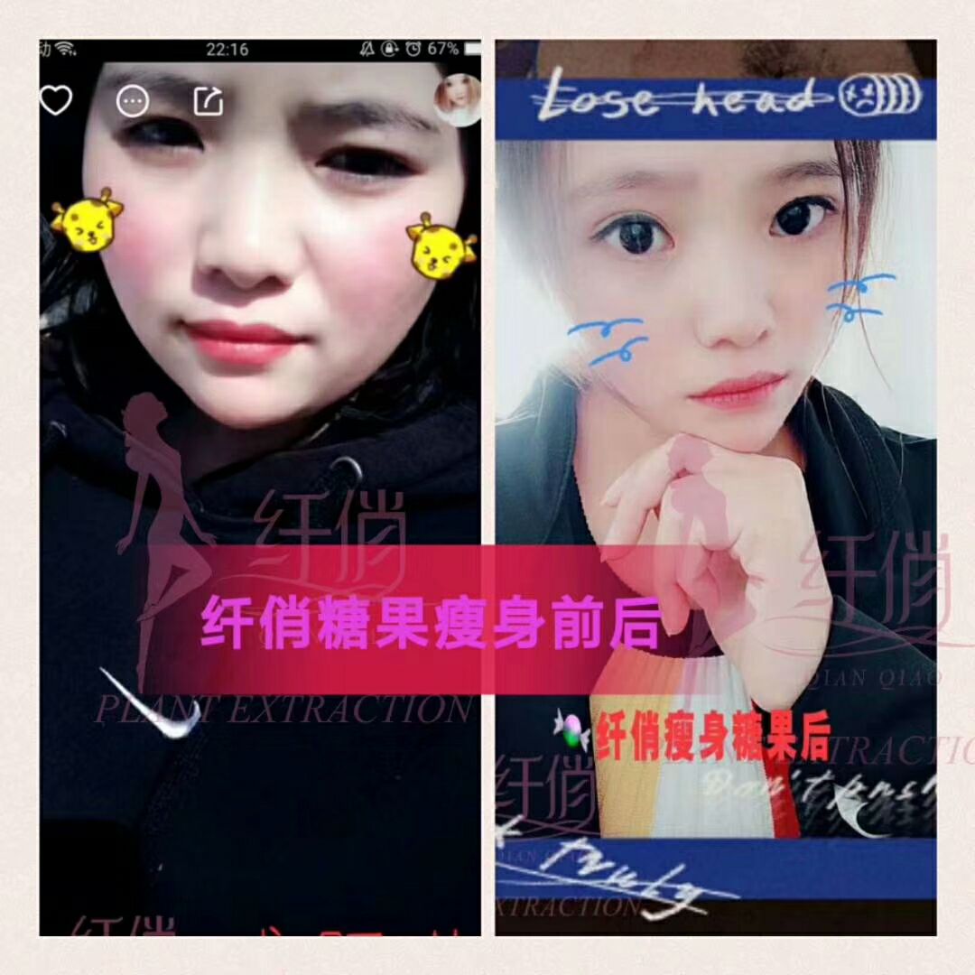 纤俏减肥糖果 减肥失败的看过来～
