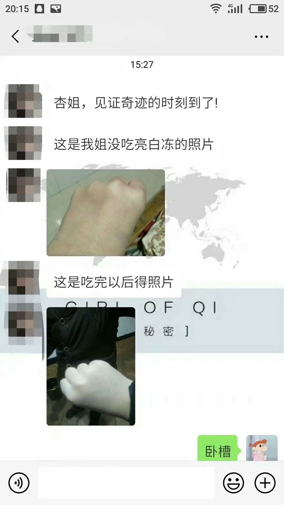 针叶樱桃亮白冻  你的美白逆袭神器