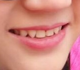 唯爱美牙仪。牙齿美白。七天见效