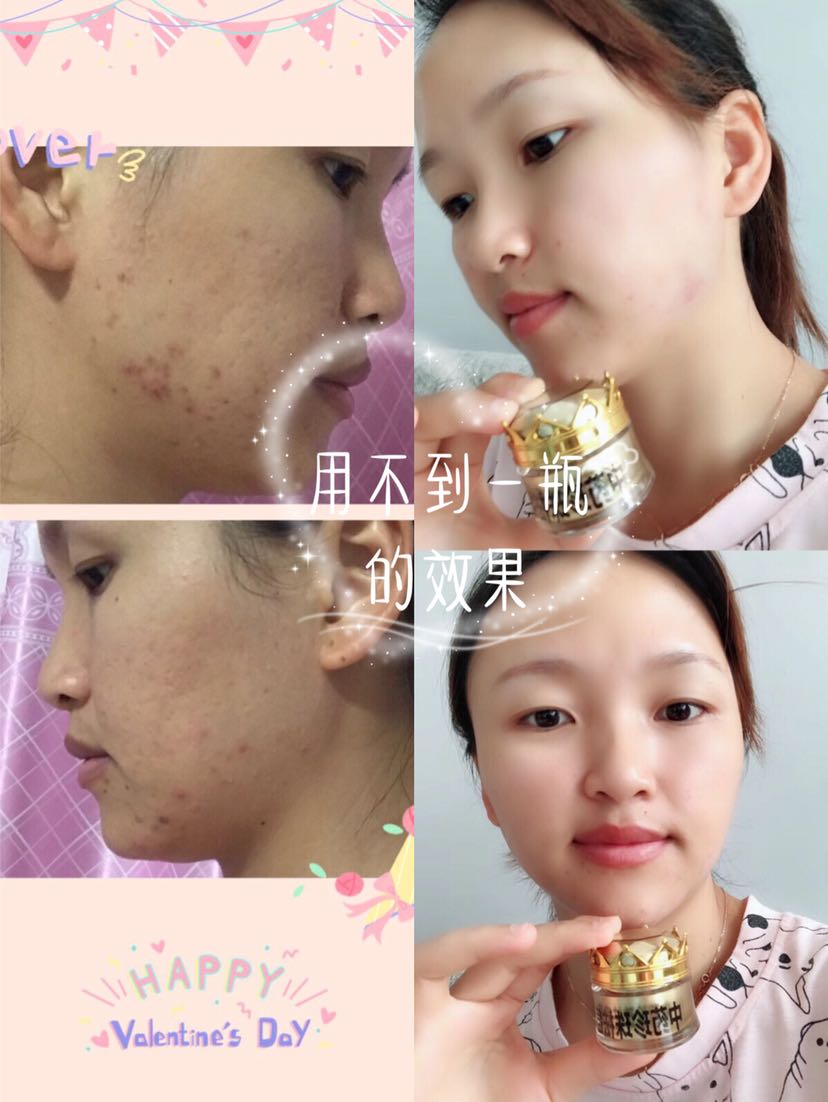 中药珍珠护肤品 全国直招代理 批发 厂家直销