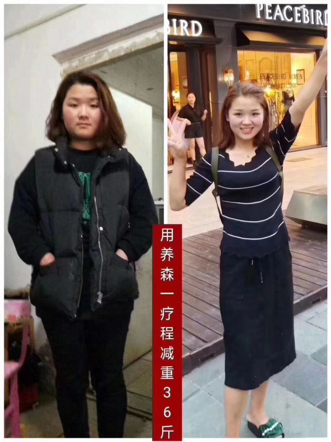 养森瘦包纯中药外敷减肥 月瘦10-30斤