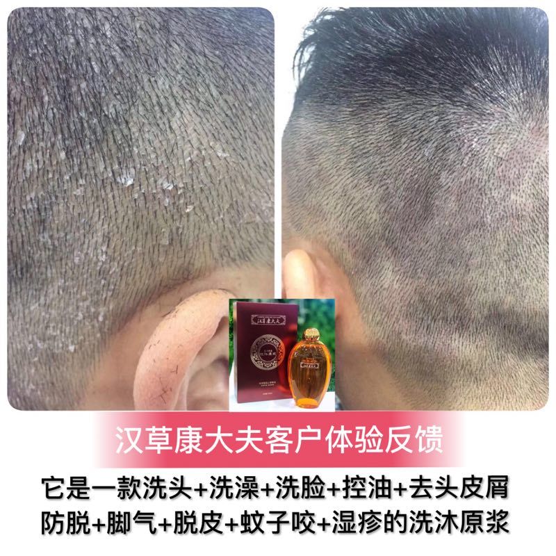 汉草康大夫洗沐原浆