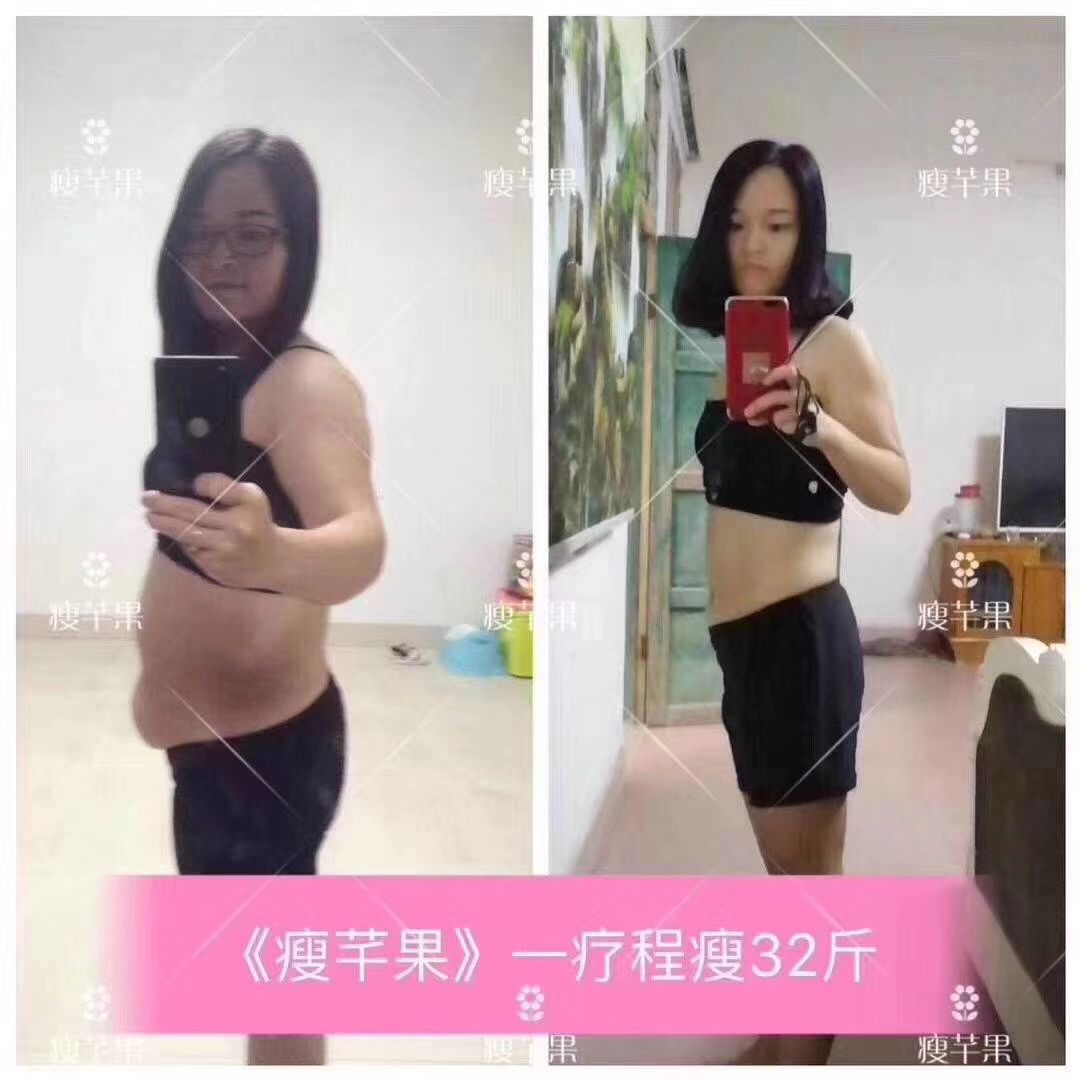 瘦芊果减肥果片
