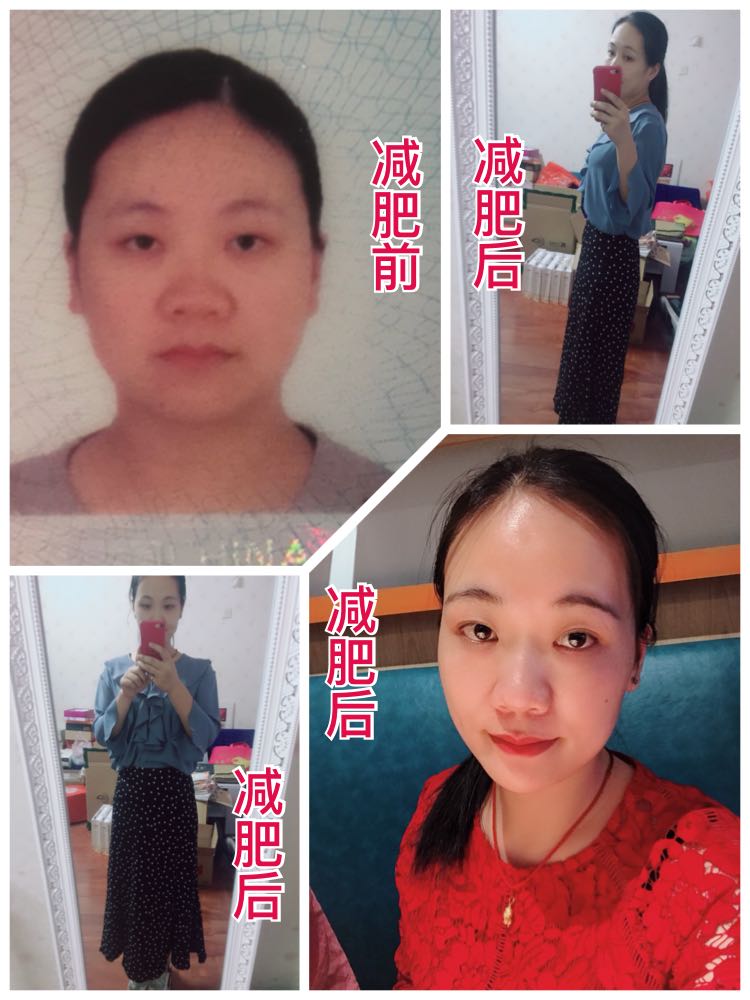 健康享瘦，不节食不吃药不打针，月瘦8-15斤。长期招代理