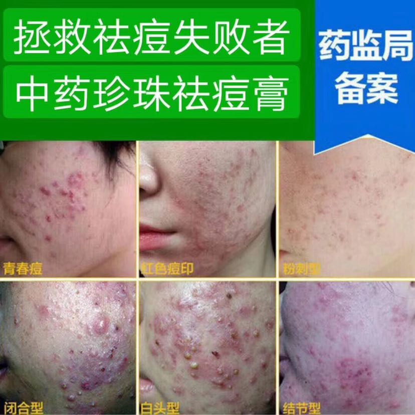 中药珍珠护肤品 全国直招代理 批发 厂家直销