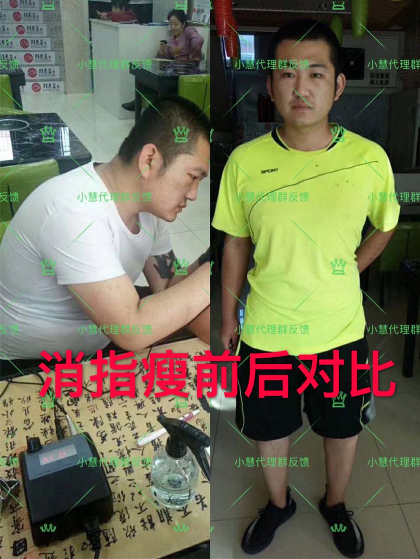 ZS消脂瘦带你月瘦10到20斤