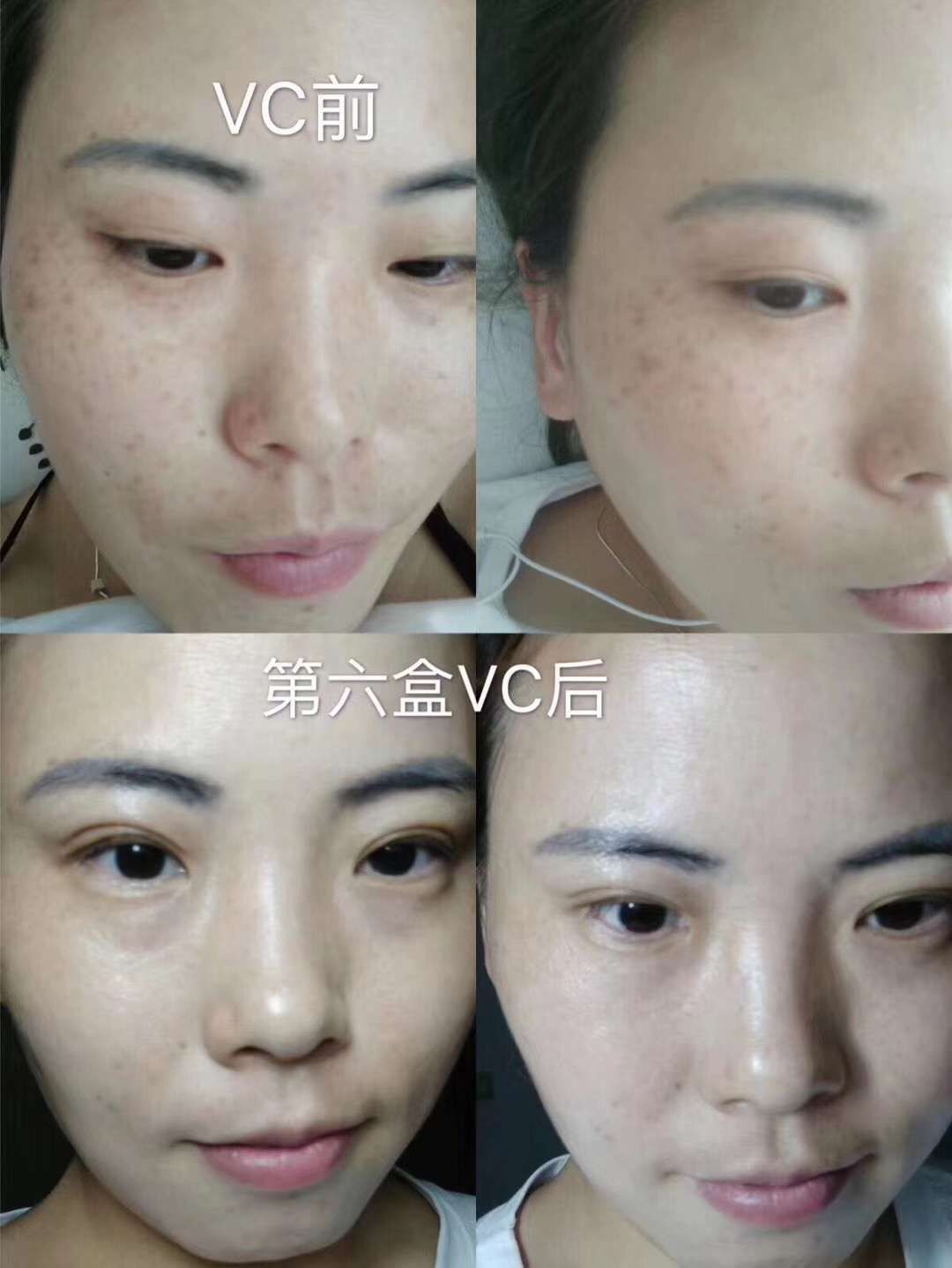 奢悦vc精华，净透vc精华，大大效果提亮肤色