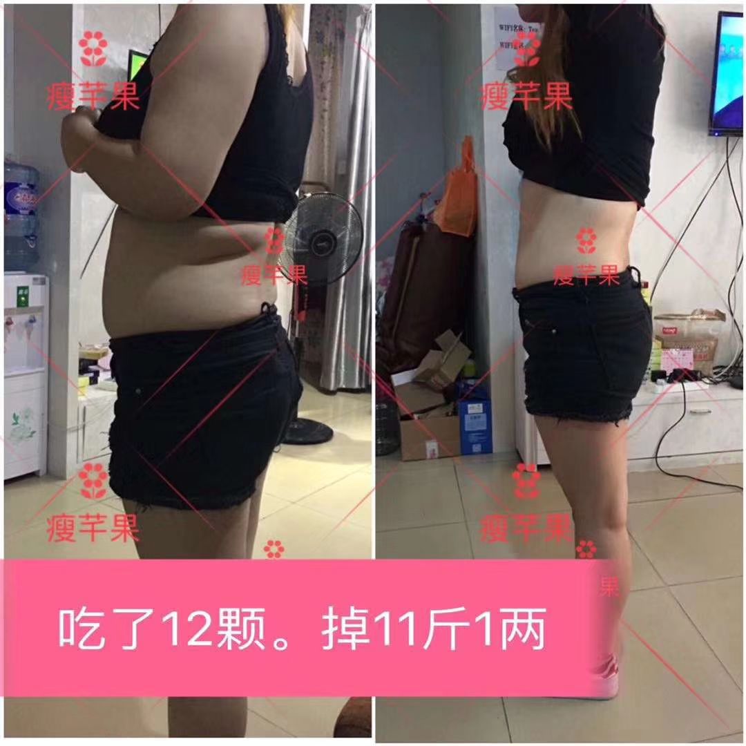 瘦芊果减肥果片