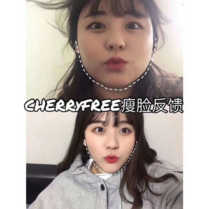 瘦脸面膜 紧致提拉皮肤消水肿 一盒使用大饼脸变成小V脸