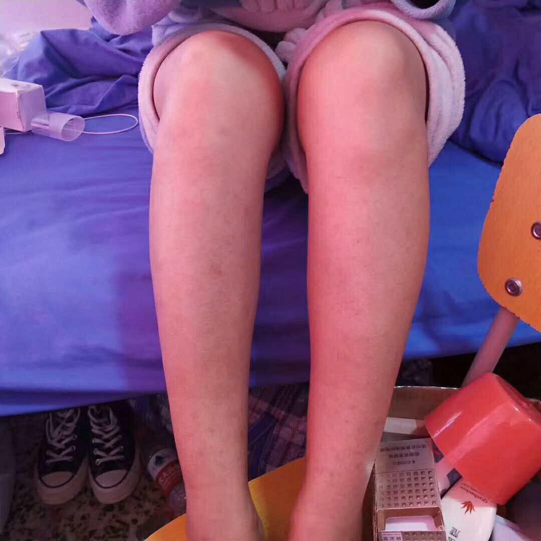 滚轮凝胶 轻松瘦腿瘦身 一次可瘦2-3厘米