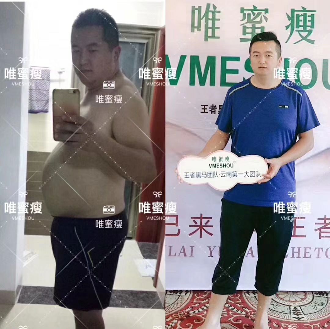 唯蜜瘦让轻轻松松躺着瘦