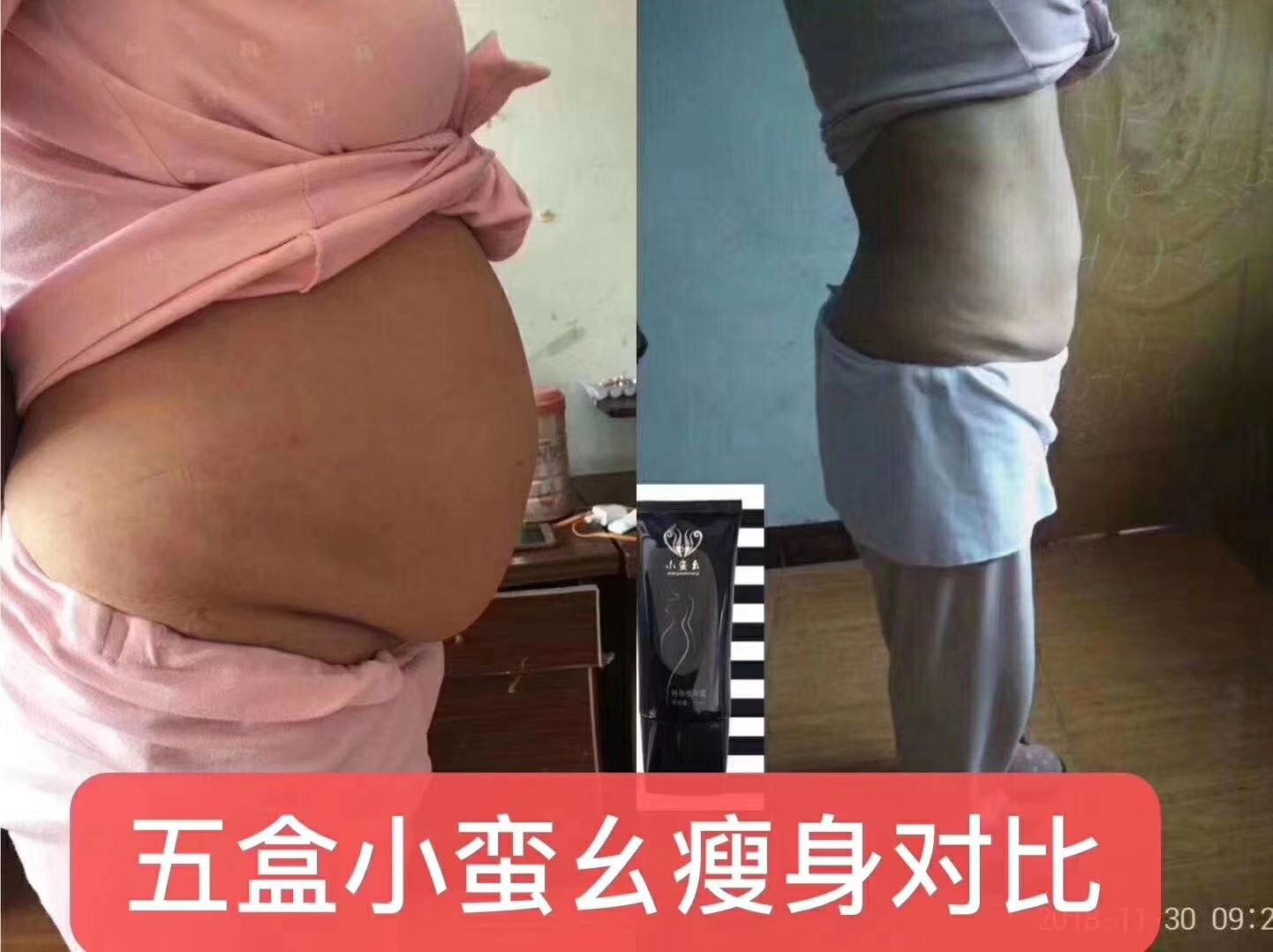 小蛮幺懒人抹抹瘦