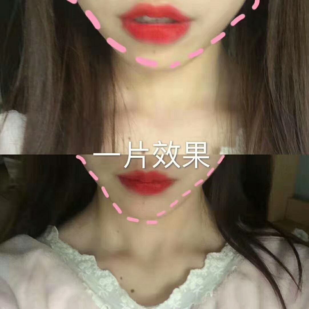 滚轮凝胶 轻松瘦腿瘦身 一次可瘦2-3厘米