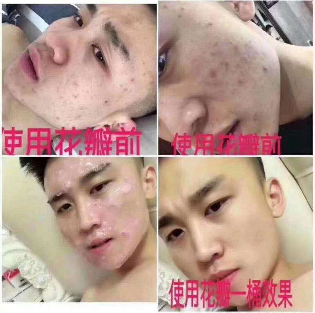 冰亦花瓣冰膜招代理 满足你的日常肌肤所需