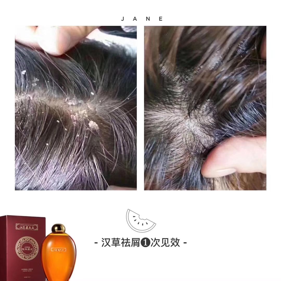 汉草康大夫草本洗沐液 养生洗沐第一品牌