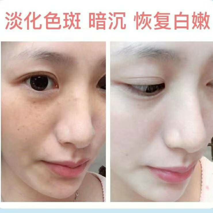 玻尿酸爆水面膜 肤姿美 懒人睡眠 免洗 美白 保湿补水 正品