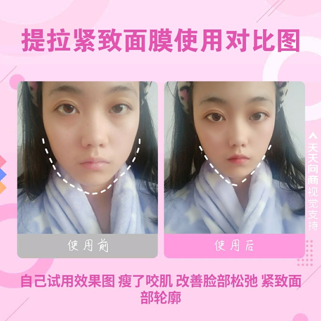 ▹ 奢貌SHEMAO V脸面膜® 瘦脸黑科技 带你逆袭小V脸