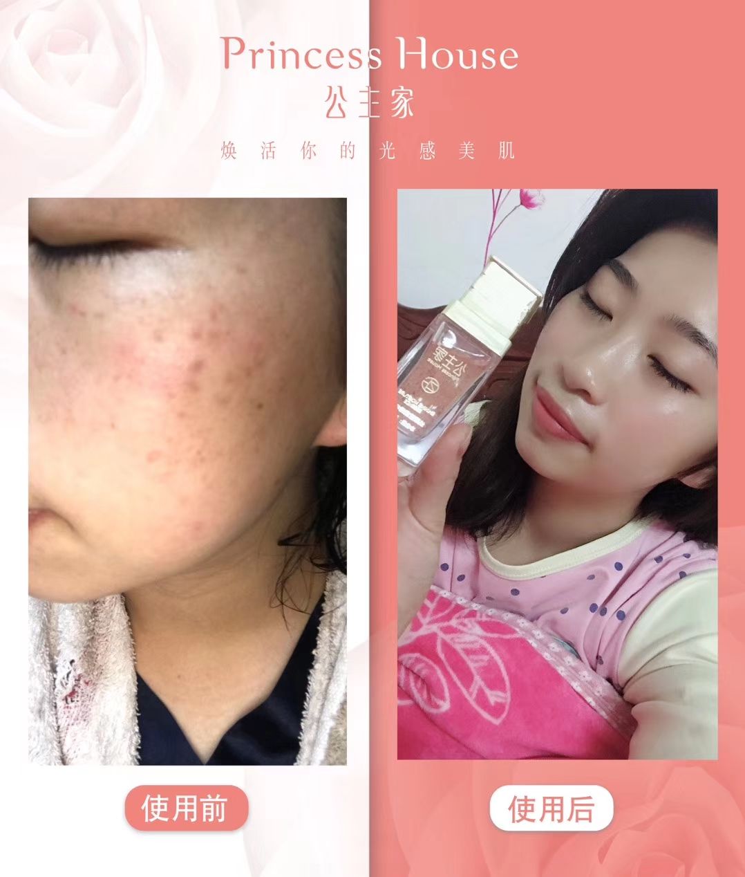 护肤瘦身产品