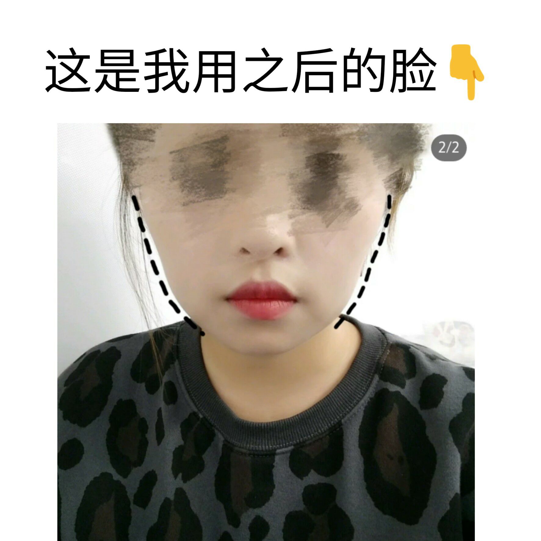 奢貌V脸面膜