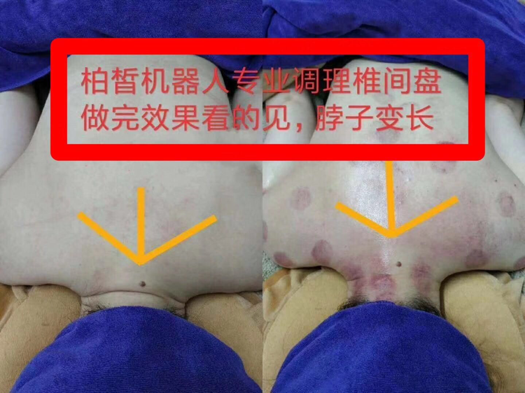 百度第一☝️机器人养生