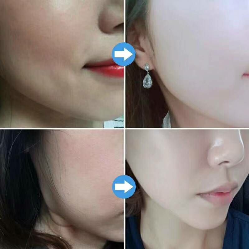 玻尿酸爆水面膜 肤姿美 懒人睡眠 免洗 美白 保湿补水 正品